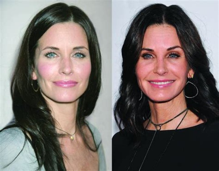 Courteney Cox's Plastic Surgery Regrets: A Cautionary Tale